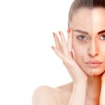 Rajeunir le regard - chirurgie esthétique - Docteur Richard Aziza