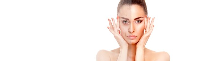 DR AZIZA Medecine Esthetique Slider 3