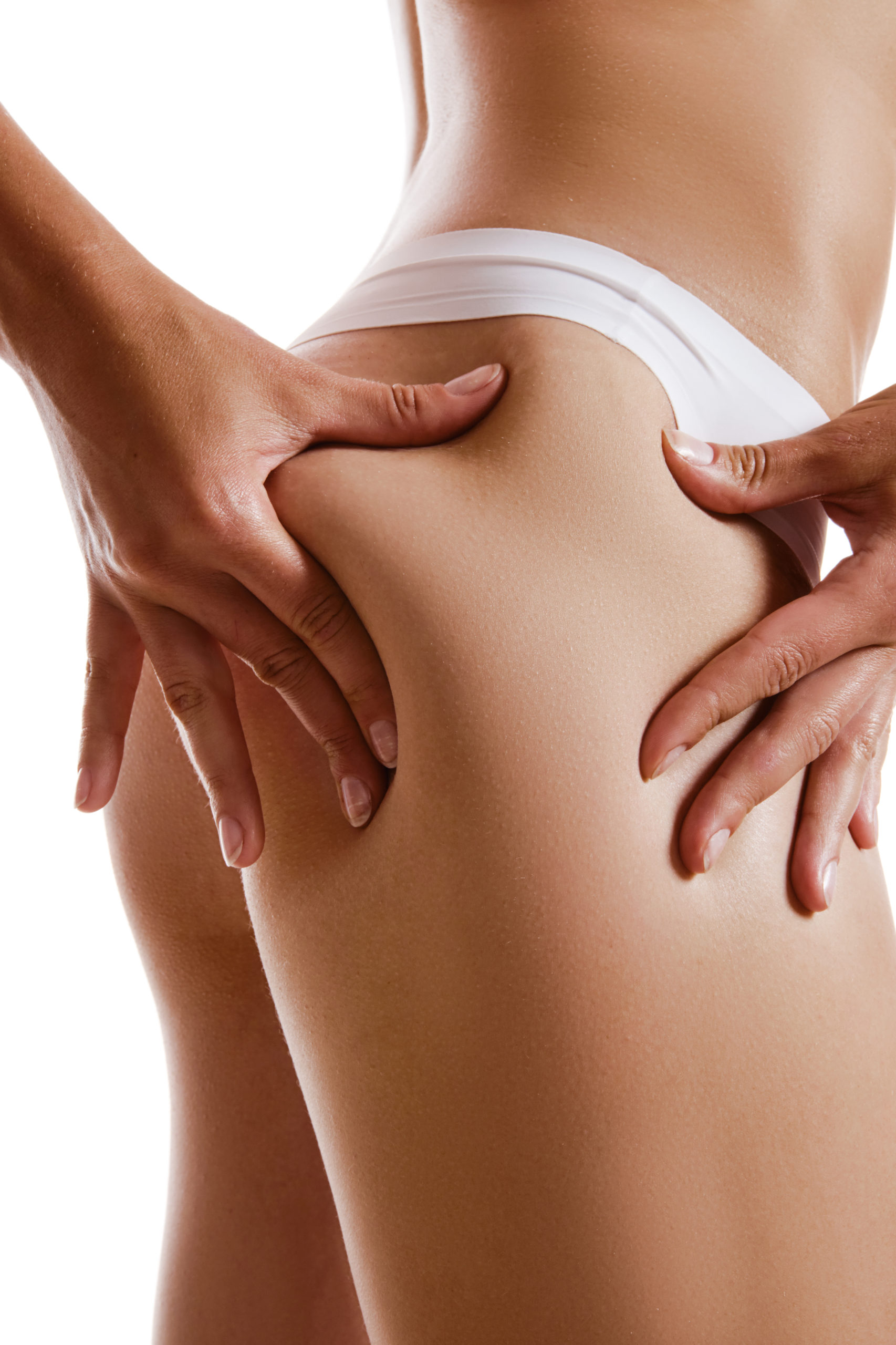 La liposuccion ou la lipoaspiration